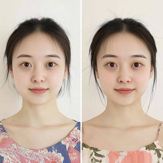 菱形臉怎么改變臉型，菱形臉重塑柔美臉型